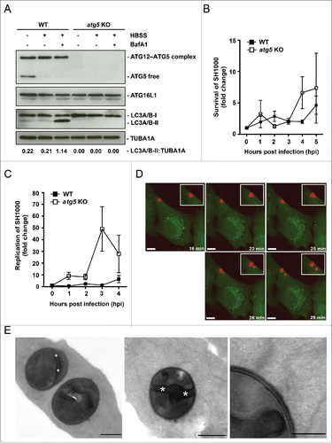 Figure 5. Cytosolic replication of S. aureus. (A) Cellular lysates of atg5 KO and ATG5-reconstituted MEFs were prepared and analyzed by immunoblotting using the indicated antibodies. (B) MEFs reconstituted with wild-type ATG5 (ATG5 WT) and atg5 KO MEFs were infected with wild-type SH1000. Survival of intracellular S. aureus was measured hourly. (C) Cells were infected as in (B). Bacterial load was measured hourly in the whole culture, i.e., including dead cells and the supernatant. (D) NIH/3T3 GFP-LC3B cells were infected with SH1000-RFP and recorded via live-cell imaging (recording 3 time points/min) shown are 5 time points. Scale bars: 8 µm. (E) NIH/3T3 cells were infected with SH1000-RFP. Two hpi cells were fixed and cut in ultrathin sections. Dividing bacteria are characterized by the septum, the dividing zone within bacteria (marked by asterisks). They are detectable in the cytoplasm with no visible membrane surrounding the bacteria. Scale bars: 500 nm in the left and middle image and 200 nm in the right image.