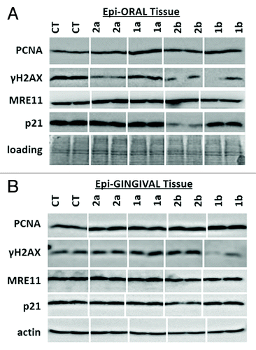 Figure 2. Expression of PCNA, γH2AX, MRE11 and p21 in EpiOral (A) and EpiGingival (B) tissues treated with 1a, 1b, 2a, and 2b antioxidants. CT, control tissues; 1a, 1b, 2a, 2b, tissues treated with antioxidants. Antioxidants: 1a, 6′-hydroxy-2′,5′,7′,8′-tetramethylchroman-2′-yl) methyl 3,4,5-trihydroxybenzoate; 1b, 6′-hydroxy-2′,5′,7′,8′-tetramethylchroman-2′-yl) methyl 3,5-dimethoxy-4-hydroxycinnamate; 2a, N-decyl-N-(3,5-dimethoxy-4-hydroxybenzyl)-3-(3,4-dihydroxyphenyl) propanamide; 2b, N-decyl-N-(3-methoxy-4-hydroxybenzyl)-3-(3,4-dihydroxyphenyl) propanamide.