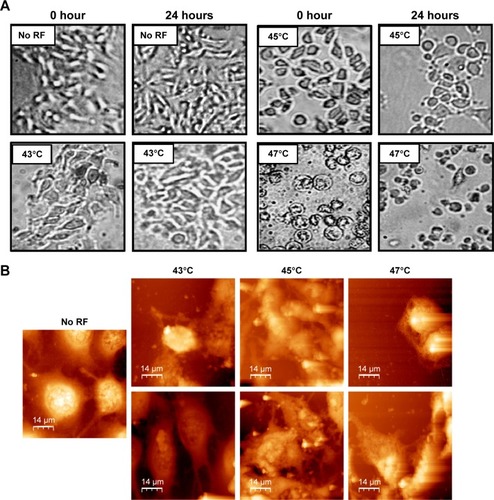 Figure 8 (A) Optical microscopic images (100×) of B16F1 cells at 0 hours and 24 hours after a single cycle of RF-induced dextran-coated LSMO-mediated hyperthermia at different temperatures. (B) Atomic force microscopy images of B16F1 cells, 0 hours (upper panel) and 24 hours (lower panel) after a single cycle of RF-induced dextran-coated LSMO-mediated hyperthermia at different temperatures as compared with no RF controls.Abbreviations: LSMO, La0.7Sr0.3MnO3; RF, radiofrequency.