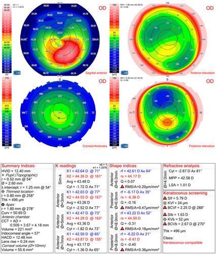 Figure 1 CSO Sirius scan image of a case of KC.