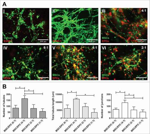 Figure 1. Network formation of MSC-EPC co-cultures. (A) Fluorescent images of networks formed by EPCs (I) and MSCs alone (II). Live cells in green (calcein); dead cells in red (ethidium homodimer-1). The scale bar represents 200 µm. Fluorescent image of MSCs (DiO, green) and EPCs (DiI, red) co-cultures after 7 days in 50% Matrigel (III). The scale bar represents 100 µm. Fluorescent images, MSCs (DiO, green) and EPCs (DiI, red) at a 6:1, 4:1 and 2:1 ratios after 14 days of culture (IV,V,VI). The scale bar represents 200 µm. (B) Day 14 analysis of three MSC donors combined with three EPC donors at different ratios, looking at number of tubules, total tubule length (µm) and number of junctions.