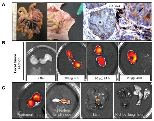 Figure 9 Biodistribution of T22-empowered nanoparticles in an animal model of colorectal cancer. (A) Nude mouse bearing a local tumor (black asterisk), mesenteric lymph node (black arrow), and peritoneal metastases (empty arrow) after microinjecting 2 × 106 SW1417 human colorectal cancer cells into the cecal wall. The local tumor and mesenteric lymph node metastases overexpress CXCR4 in this model, as assessed by immunohistochemistry. (B) Selective biodistribution of T22-GFP-H6 in local tumor tissues 5, 24, or 48 hours after intravenous administration of 500 μg or 20 μg of nanoparticles as measured ex vivo. Fluorescence was undetectable in tumors from buffer-treated animals. (C) Accumulation of nanoparticles in peritoneal and lymph node metastases. No fluorescence was observed in any normal (liver, kidney, lung, heart) tissue, except for the biliary vesicle which showed fluorescence both in control and experimental animals.Abbreviation: GFP, green fluorescent protein.