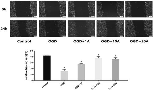 Figure 4. Effects of alisol A 24-acetate on migration capabilities. Cell migration ability was measured (n = 5). vs. the control group (*p < 0.05), vs. the OGD group (#p < 0.05). Results are presented as means ± standard deviation (SD).