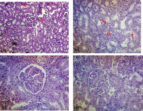 Figure 4. Histopathology of kidney of experimental rats (a) Section from kidney of normal histology of the kidney with normal structure of the glomeruli and tubules [H & E × 400]; (b) Section from kidney of diabetic rats showing hypertrophic glomeruli with reduction in the urinary space [red arrow]. The renal tubular epithelium showing some vacuolar degeneration [H & E × 400]; (c) Section from kidney of glibenclamide treated rats showing normal hepatic histomorphology [H & E × 400]; (d) Section from kidney of MEMP extract treated rats showing normal hepatic histomorphology [H & E × 400].G: Glomerulus; T: Tubule
