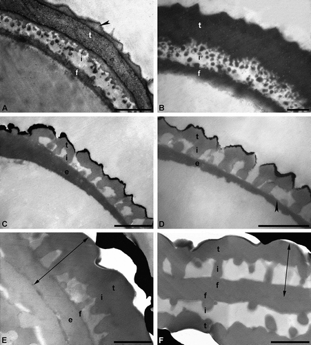 Figure 4. Cross-sections of pollen walls showing the effect of using different TEM staining agents. A, B. Pollen wall of a recent dispersed pollen grain, stained with potassium permanganate (KMnO4) (A) and uranyl acetate/lead citrate (B), pollen without gold coating. Pollen wall in interapertural region with tectum: eutectate (t) with inner channelled layer and outer thin layer (arrowhead), infratectum: granular (i), foot layer: continuous-compact (f). C, D. Pollen wall of a single in situ pollen out of a fossil flower (anther) from the Eocene of Messel, Germany, stained with KMnO4 (C) and uranyl acetate/lead citrate (D). Pollen wall with tectum: eutectate (t), infratectum: columellate (i), foot layer: thin and discontinuous (arrowhead), endexine: continuous-compact (e), outermost black layer is the gold coating. E, F. Pollen wall of a single dispersed fossil pollen grain from the early Miocene of Ethiopia, Africa, stained with KMnO4 (E) and uranyl acetate/lead citrate (F), gap between pollen wall and gold layer (black) is formed when the formvar film is too thin. Two-headed arrows indicate the exine. Pollen wall in interapertural area with tectum: eutectate (t), infratectum: columellate (i). It is uncertain if the foot layer (f) is thick (F) or thin (E), in case of the latter accompanied by a thick endexine (e). Scale bars – 1 µm (A–F).