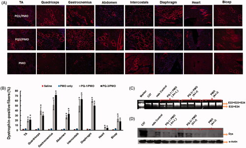 Figure 5. Restoration of dystrophin expression after two-week systemic delivery of PMO with PQs in mdx mice (aged 4–5 weeks). Each mouse was injected with 1 mg PMOE23 with and without PQs (0.5 mg). (A) Dystrophin was detected by immunohistochemistry with rabbit polyclonal antibody P7 against dystrophin. Blue nuclear staining with DAPI, and original magnification: ×100. (B) Percentage of dystrophin-positive fibers in different muscle tissues (mean ± SEM, n = 5, two-tailed t-test, *p ≤ .05 compared with 1 mg PMO only). (C) Detection of exon 23 skipping by reverse transcription polymerase chain reaction. Total RNA of 100 ng from each sample was used for amplification of dystrophin mRNA from exon 20 to exon 26. The upper bands correspond to the normal mRNA, and the lower bands correspond to the truncated mRNA with exon E23 skipped. (D) Western blots demonstrate the expression of dystrophin protein from treated mdx mice in comparison with C57BL/6 and untreated mdx mice (20 μg of total protein was loaded for PQ-formulated PMO, PMO-treated mice, WT C57 and control mdx. A: TA; I: Diaphragm; J: Heart). Dystrophin detected with monoclonal antibody Dys 1. α-Actin was used as the loading control.