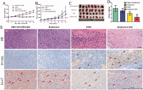 Figure 10. In vivo anticancer efficacy evaluation. (A) Body weights of mice after different treatments. (B) Cancer growth curves of different groups of cancer-bearing mice after various treatments indicated for 12 days. (C) Pictures of the harvested cancers. (D) Cancer weight of different groups. *p< .01 vs. PBS; #p< .05 vs. EMS or PBS. Data were presented as mean ± SD, n = 8. (E) H&E, TUNEL, and Ki-67 staining in cancer sections collected from differently treated groups of mice. ‘↗’ represents cancer cells apoptosis and proliferation, respectively.