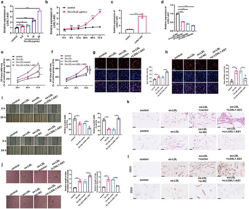 Figure 1. LOXL1-AS1 promoted Ox-LDL-mediated angiogenesis. A: Different concentrations of Ox-LDL (2.5–20 μg/ml) were applied to treat HUVECs for 24 hours, and LOXL1-AS1 expression was detected via RT-PCR; B: Ox-LDL (5 μg/ml) was applied to HUVECs for different times (0–72 h), and RT-PCR was performed to measure the expression of LOXL1-AS1 in the HUVECs, ns p > 0.05, *** p < 0.001 vs. control group. N = 3; C-D: Overexpression (c) and low expression (d) of LOXL1-AS1 cell model were constructed in HUVECs; Ox-LDL (5 μg/ml) were applied to treat HUVECs with different level of LOXL1-AS1 for 24 hours. E-F: CCK8 was carried out to examine the proliferation of HUVECs; G-H: The cell viability of HUVECs was evaluated via EdU method; I: HUVECs’ migration was examined by cell scratch test; J. HUVECs’ angiogenic ability was detected via the tube formation assay. K-L: matrigel plug assay was used to evaluate the angiogenesis of HUVECs in vivo. the matrigel plugs were harvested at 1-wk post-implantation and then subjected to hematoxylin-eosin staining and immunohistochemical staining (for detecting CD31). *, **, *** represents p < 0.05, p < 0.01 and p < 0.001, respectively. N = 3