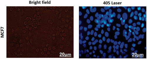 Figure 6. Fluorescence microscopy images of treated human breast epithelial adenocarcinoma (MCF-7) cells with the methotrexate (MTX) loaded developed nanocarrier under bright field and 405 nm excitation after 3 h (scale bar = 20 μm).