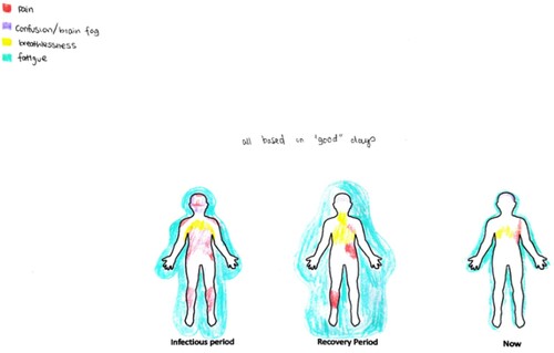 Figure 5. Body Mapping by Sophie to express symptoms of COVID-19.