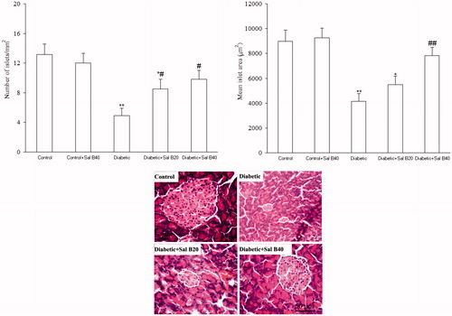 Figure 4. The number of pancreatic islets/mm2 and their mean area (top panel) and photomicrographs of pancreatic sections stained with H&E (bottom panel) after 3 weeks of Sal B administration. Sal B20 and Sal B40 indicate salvianolic acid B at doses of 20 and 40 mg/kg, respectively (n = 3 for each group). *p < 0.05, **p < 0.01 (versus control), #p < 0.05, ##p < 0.01 (versus diabetic).