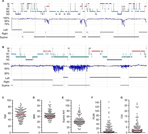 Figure 4 AHI: a limited view of heterogenous sleep physiology