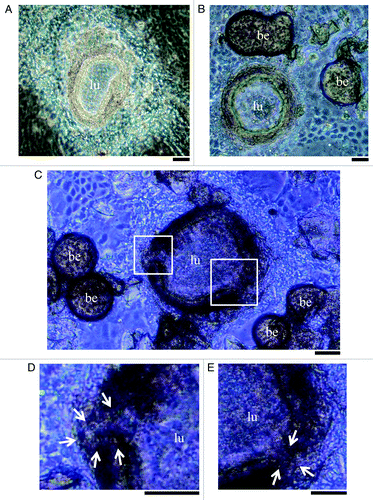 Figure 1. (A) A typical mouse ES cell-derived three-dimensional structure (ES 3-D structure) on day 16 of embryoid body (EB) outgrowth culture. (B) Representative example of ES 3-D structure planted control heparin beads (day 16). No morphological differences were observed among these conditions during our culturing protocol. (C) Representative example of ES 3-D structure treated with heparin beads soaked in FGF10 (day 16). Bud-like processes extending from the structural inner layer were observed. (D and E) Higher magnification of the bud-like processes within the white squares in (C). (lu) structural lumen; (be) heparin-coated bead. Scale bar indicates 100 μm. Arrows indicate the bud-like processes.