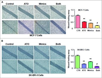 Figure 4. Effect of let-7a on cell motility. (A) Left panel: Cell migration was measured using Wound-healing assay in MCF-7 breast cancer cells after ATO treatment or let-7a mimics or the combination. Right panel: Quantitative results are illustrated for left panel. **P<0.01, compared with control; #P<0.05, compared with ATO alone or let-7a mimics alone. ATO: 8 μM ATO; Mimics: let-7a mimics: Both: 8 μM ATO plus let-7a mimics. (B) Left panel: Wound-healing assay was performed to measure the cell migration in SK-BR-3 cells after ATO treatment or let-7a mimics or the combination. Right panel: Quantitative results are illustrated for left panel. **P<0.01, compared with control; #P<0.05, compared with ATO alone or let-7a mimics alone.
