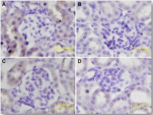 Figure 7 Representative images of tumor tissues after anti-CD31 staining (bar=25 μm). Mice were iv injected with free MGF, MGF-SLNs and Tf-MGF-SLNs at a MGF dose of 10 mg/kg via the tail vein on days 6, 9, and 12 after tumor implantation. Controls included mice that were injected with blank SLNs. (A) Blank SLNs; (B) free MGF; (C) MGF-SLNs; (D) Tf-MGF-SLNs.