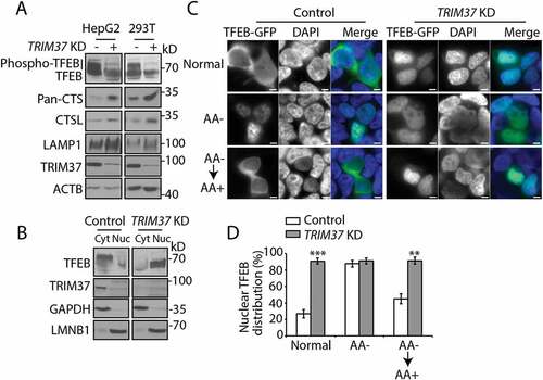 Figure 5. TRIM37 depletion reduces TFEB phosphorylation and induces TFEB nuclear translocation. (a) HepG2, HEK 293T control, and TRIM37 KD cells grown in normal growth media were collected for protein detection with the indicated antibodies. The smeared bands represent TFEB phosphorylation (phospho-TFEB). Pan-cathepsin (pan-CTS) antibody recognizes cathepsin family proteins. ACTB is used as a loading control. (b) HepG2 control and TRIM37 KD cells were fractionated into cytoplasm (Cyt) and nucleus (Nuc), followed by protein detection with the indicated antibodies. GAPDH and LMNB1 (lamin B1) were used as control proteins for cytoplasmic and nuclear fractions, respectively. (c and d) The TFEB-GFP expression construct was transfected into HepG2 control or TRIM37 KD cells. After 24 h, cells were incubated in amino acid-free media for 2 h (AA-), followed by incubation in amino acid-containing media (AA+) for 2 h. Normal, shows cells grown in normal growth media. Nuclei were stained with DAPI. Scale bars: 5 μm. (d) Quantification of cells shown in (c). Approximately 20–30 cells expressing TFEB-GFP were obtained and the percentages of cells with predominantly nuclear TFEB-GFP distributions were quantified. The results are presented as mean ± SEM (n = 3) based on 3 independent experiments. **, p < 0.01; ***, p < 0.001 (Student’s t test)