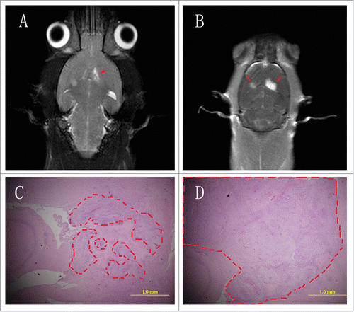 Figure 6. Exogenetic expression of miR-302c-3p suppresses glioma cell tumorigenesis in rat brain. (A) T2 weight image. The left side is C6–302c-3p cells. The right side is C6-NC cells. Red arrows indicated the tumors. (B) Enhanced T2 weighted images. The left side is C6–302c-3p cells. The right side is C6-NC cells. Red arrows indicated the tumors. (C) C6–302c-3p group (C) and C6-NC group (D). Dashed box indicated tumors (original magnification 40×).