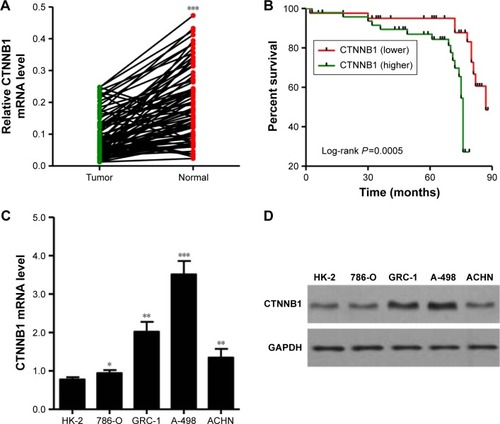 Figure 1 Correlation between CTNNB1 expression and survival time of patients with clear cell RCC. (A) The expression level of CTNNB1 was detected by real-time PCR in 90 clear cell RCC tissues and their adjacent normal tissues. (B) The survival time of 90 clear cell RCC patients showed that a higher CTNNB1 expression level was correlated with poor survival. (C) mRNA expressions of CTNNB1 and GAPDH were determined by real-time PCR using a CTNNB1-specific primer set. (D) β-catenin protein expression was analyzed by Western blot using anti-CTNNB1 antibody. *P<0.05, **P<0.01, ***P<0.001 compared with tumor tissues.