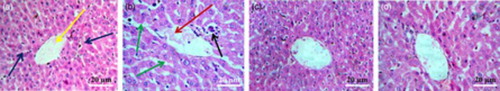 Figure 3 Histological sections of livers of normal mice (A), NaAsO2-treated mice (B), mice pretreated with AEEF (50 mg/kg) followed by NaAsO2 (C), and mice pretreated with AEEF (100 mg/kg) followed by NaAsO2 (D). Blue arrows represent normal hepatocytes and yellow arrow represents central vein; red arrow represents dilated portal vein; green arrows represent enlarged sinusoids between the plates of hepatocytes; and black arrow represents infiltrating leukocytes.