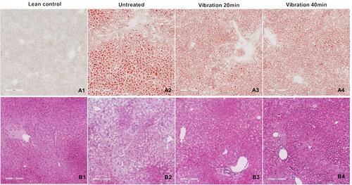 Figure 3 (A) Oil Red O staining. (B) H&E staining.Notes: Several slices liver cutting from different region of the whole liver were embedded in OCT and paraffin. The frozen samples were cut in 10μm slice then staining with Oil red O. The paraffin samples were cut in 6μm then with H&E. Taking pictures with 100 folds.