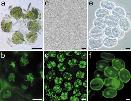 Figure 2. An illustration of different cell types released from asparagus anthers. (a). Released meiotic cell clusters with a worm shape containing prophase I meiocytes. (c). Separated meiocytes with cells mainly at tetrad stage. (e). Microspores. (b), (d), and (f) are the labeling results of different cell types shown in (a), (c), and (e), respectively. Bars, 250 μm (a); 10 μm (b-f).