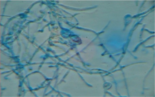 Figure 3 Trichophyton tonsurans (lactophenol cotton blue mount).