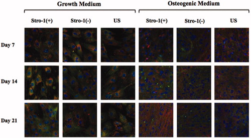 Figure 9. Confocal microscopy images of STRO-1(+), STRO-1(−) and US pTGSCs after 7, 14 and 21 days of incubation in GM or OM (20X objective). Scale bars show 20 μm. Osteocalcin (red), collagen type I (green).