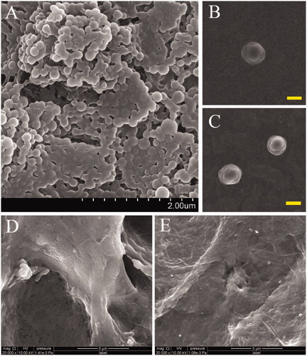 Figure 1. High-magnification SEM images presented the spherical appearance of B-NPs (A), V-NPs (B) and N-NPs (C), respectively, all with smooth surfaces in morphology. High magnification SEM images shown in (D,E) displayed the morphology of VN-ASCS before and after the GP crosslinking, indicating that numerous NPs were conjugated into the ASCS internal surface successfully. Scale bar: A for 2.0 μm; B,C for 200 nm; D,E for 5.0 μm.