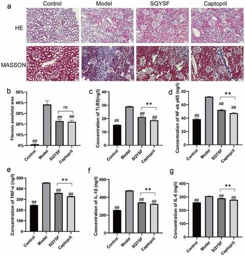 Figure 2. SQYSF alleviated renal inflammation and fibrosis in CKD mice. (a) HE staining to detect kidney morphology in each group, Masson staining to detect kidney fibrosis in each group. (b) Masson staining statistical results. (c–g) ELISA to detect the contents of TLR5, NF-κb, p65, TNF-α, IL-1β and IL-6 in each group of serum samples. ##, p < 0.01, which were compared with model group. ns, p > 0.05, **, p < 0.01, SQYSF compared with captopril group.