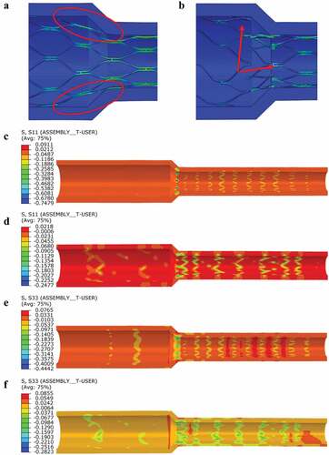 Figure 4. Deployment simulation of stents into vessels with varying inner diameters: (a, b) wall apposition of the stent, (c, d) S11 stress distribution of the stent on the vessel wall, (e, f) S33 stress distribution of the stent on the vessel wall. (a, c, e) Stent-CC, (b, d, f) CC3B stent.
