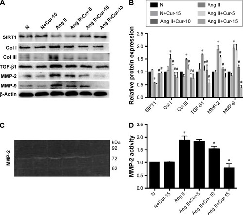 Figure 4 Effects of curcumin (Cur) on fibrosis in Ang II-treated cardiac fibroblasts (CFs).