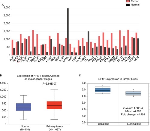 Figure 1 Expression profiles of NPM1 in breast cancer tissue samples from an array of databases.Notes: (A) The mRNA expression of NPM1 in different tumor types. (B) The expression of NPM1 in normal and primary tumor tissues. (C) Box plots derived from gene expression data in ONCOMINE comparing the expression of NPM1 in basal-like and luminal-like tumors.Abbreviations: ACC, adrenocortical carcinoma; BLCA, bladder urothelial carcinoma; BRCA, breast invasive carcinoma; CESC, cervical squamous cell carcinoma and endocervical adenocarcinoma; CHOL, cholangiocarcinoma; COAD, colon adenocarcinoma; DLBC, lymphoid neoplasm diffuse large B-cell lymphoma; ESCA, esophageal carcinoma; GBM, glioblastoma multiforme; HNSC, head and neck squamous cell carcinoma; KICH, kidney chromophob; KIRC, kidney renal clear cell carcinoma; LAML, acute myeloid leukemia; LGG, lower grade glioma; LIHC, liver hepatocellular carcinoma; LUAD, lung adenocarcinoma; LUSC, lung squamous cell carcinoma; MESO, mesothelioma; OV, ovarian serous cystadenocarcinoma; PAAD, pancreatic adenocarcinoma; PCPG, pheochromocytoma and paraganglioma; PRAD, prostate adenocarcinoma; READ, rectum adenocarcinoma; SARC, sarcoma; SKCM, skin cutaneous melanoma; STAD, stomach adenocarcinoma; TGCT, testicular germ cell tumors; THCA, thyroid carcinoma; THYM, thymoma; UCEC, uterine corpus endometrial carcinoma; UCS, uterine carcinosarcoma.