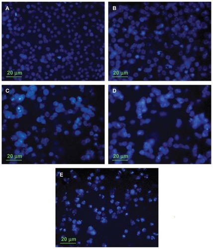 Figure 7 Nuclear morphologies of MCF-7 cells using Hoechst 33342 staining. Cells were treated with PTX in solution or in drug-loaded micelles containing total PTX concentration of 20 nM for 48 h. (A) Control; (B) PTX solution; (C) Taxol; (D) DOMC /PTX; (E) DOMC-FA/PTX.Abbreviations: DOMC, deoxycholic acid-O-carboxymethylated chitosan; FA, folic acid; PTX, paclitaxel.