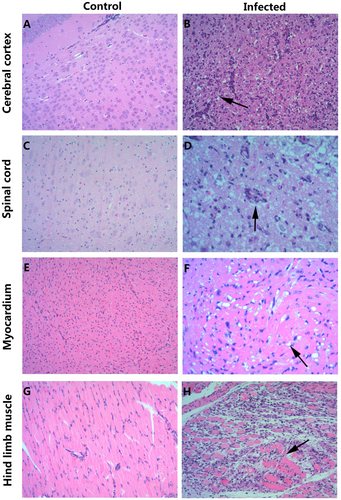Fig. 3 HE staining of various tissues from the BALB/c neonatal mice that were i.p. challenged with CV-B5/JS417.a, c, e, g HE staining of cerebral cortex, spinal cord, myocardium, and hindlimb muscle tissues of the control group, respectively. b, d, f, h HE staining of corresponding tissues of the experimental group. b Necrosis of the cerebral cortex associated with tubular infiltration (arrow); d: degeneration and necrosis of spinal cord nerve cells with glial response (arrow); f: eosinophilic necrosis of cardiomyocytes (arrow); h: necrotic myositis of hindlimb muscle (arrow). Magnifications ×100 (a–c, e, g, h), Magnifications ×200 (d, f). n = 6–10 mice for each group. One representative image is shown