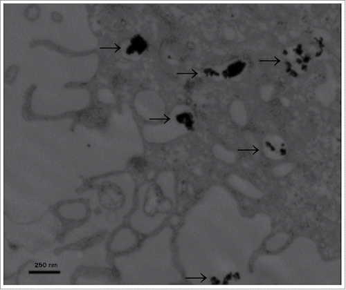 Figure 1. Transmission electron microscopy. ZnO-NPs typically clotted together in various intracellular patches of different amounts (indicated by black arrows). Scale bar represents 250 nm, image was taken at 40.000x magnification.