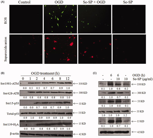 Figure 5. Se-SP suppresses OGD-induced oxidative damage by inhibiting ROS accumulation. (A) Se-SP prevented OGD-induced ROS accumulation. Primary neurons were loaded with DCFH-DA or Mito-SOX before treatment for detection of ROS and superoxide anion, respectively. Images were observed by a fluorescence microscope. (B) Time-dependent DNA damage in OGD-treated neurons. (C) Se-SP suppressed OGD-induced DNA damage. Details of the experiments followed the methods part. Protein expression was detected by western blotting method.