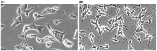 Figure 3. Comparison of the microscopic morphology of SH-SY5Y cells. (a) Normal cells; (b) OGD-treated cells.