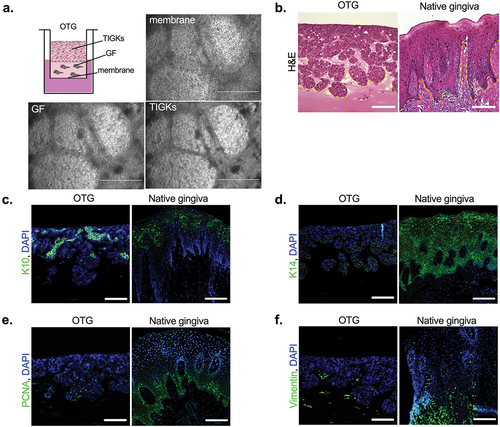 Figure 1. Morphological characteristic of the 3D gingival model. The 3D gingival model constructed from established cell lines closely represents the native gingival tissue architecture. The OTG model was constructed from GFs embedded in Matrigel® and TIGKs for the epithelial cell layer, as described in the material and Methods section. (a) Schematic drawing of the OTG model and representative microscopic images of the membrane, GFs, and TIGKs captured at the center of the culture insert by light microscopy. (b – f) Paraffin-embedded tissue sections were stained with H&E (b) To visualize morphology the multilayered (stratified) structure of the epithelium is distinguished from the connective tissue layer and fibroblasts (dashed line) located below. Immunohistochemically stained tissue processed with antibodies against epithelial (c, K10 and d, K14; green), proliferation (e, PCNA; green), and fibroblast (f, vimentin; green) biomarkers. Nuclei were stained with DAPI (blue). Scale bar in (a): 1000 μm; scale bar in (b – f): 100 μm.