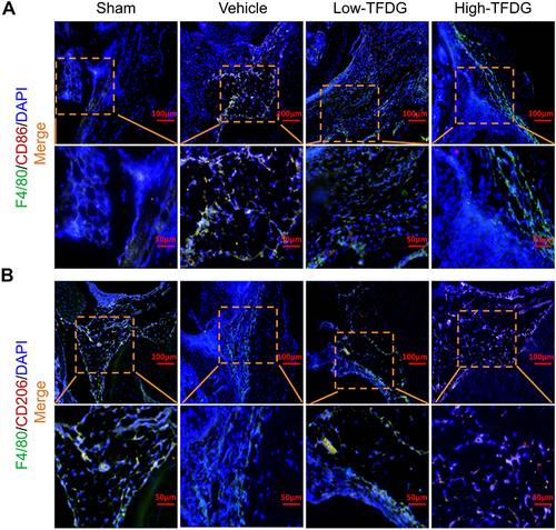 Figure 6 TFDG regulated macrophage polarization in CIA mice. (A and B) Immunofluorescence staining of F4/80(+)CD86(+) and F4/80(+)CD206(+) macrophages. (Scale bar: 100μm and 50μm.).