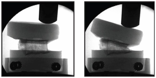 Figure 1 Vertebral specimen within loading frame before (left) and after (right) application of displacement load for creation of vertebral compression fracture.