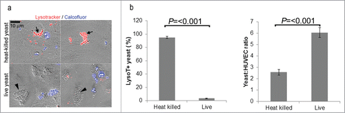 Figure 2. (A) Heat-killed and live C. parapsilosis were differentially trafficked after internalization. Overlay of brightfield DIC (gray), red (Lysotracker) and blue (calcofluor) channel fluorescence. Internalized yeast cells were negative for calcofluor. Internalized heat-killed yeast cells typically were present in a Lysotracker+ compartment (arrows). Internalized live yeast cells on the other hand were rarely stained red but were in a Lysotracker− compartment (arrowheads). Extracellular yeast cells (adherent or free floating) were brightly stained with calcofluor, and were disregarded for analysis. (B) Quantification of trafficking. The number of internalized (calcofluor−) Lysotracker+ and Lysotracker− yeast cells were manually counted, and the number of LysoT+ yeast was expressed as a percentage of the total (left panel). The right panel shows the number of internalized yeast per endothelial cell for heat-killed vs. live. The data represents the mean and SEM of 10 fields of view from each of 3 independent experiments.