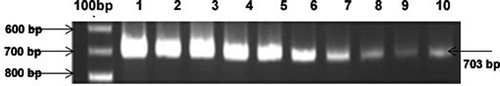 Fig. 2. PCR confirmatory analysis of viral geneome as revealed by concentration dependent PCR reaction (field resistant mungbean ML1108). Lane 1 : 50 ng, Lane 2 : 40 ng, Lane 3 : 30 ng, Lane 4 : 20 ng, Lane 5 : 10 ng ; Lane 6 : 5 ng, Lane 7 : 2.5ng, Lane 8 : 1.25ng, Lane 9 : 0.625ng, Lane 10 : 0.1325ng.