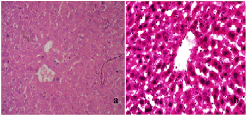 Figure 1. Normal group, section of mouse liver showing no lobular inflammation, none of necrosis and fibrosis. No abnormality of central vein and hepatocytes.