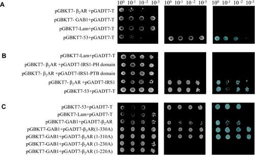 Figure 5 Self-activation verification and protein interaction tested by Y2H. (A) Self-activation verification of pGBKT7-β2AR and pGBKT7-GAB1; (B) Protein interaction between β2AR and IRS1 verified by Y2H; (C) Protein interaction between β2AR and GAB1 verified by Y2H.