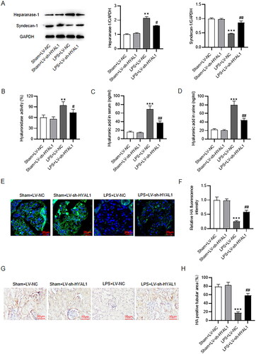 Figure 4. HYAL1 knockdown protected endothelial glycocalyx in LPS-induced AKI mice. (A) Western blotting for syndecan-1 and heparanase-1 protein levels in murine kidneys of Sham + LV-NC, Sham + LV-sh-HYAL1, LPS + LV-NC and LPS + LV-sh-HYAL1 groups. (B) ELISA for hyaluronidase activity in murine serum of Sham + LV-NC, Sham + LV-sh-HYAL1, LPS + LV-NC and LPS + LV-sh-HYAL1 groups. (C, D) ELISA for hyaluronic acid level in murine serum and urine of Sham + LV-NC, Sham + LV-sh-HYAL1, LPS + LV-NC and LPS + LV-sh-HYAL1 groups. (E) Immunofluorescence staining for hyaluronic acid level in murine renal endothelial glycocalyx of Sham + LV-NC, Sham + LV-sh-HYAL1, LPS + LV-NC and LPS + LV-sh-HYAL1 groups (scale bar = 20 μm). (F) The quantification of the hyaluronic acid fluorescence intensity. (G, H) IHC staining for hyaluronic acid level within tubulointerstitial (scale bar = 50 μm). N = 10 mice each group. **p < .01, ***p < .001 vs. Sham + LV-NC group; #p < .05, ##p < .01 vs. LPS + LV-NC group.