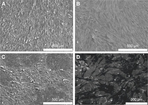 Figure 8 Scanning electron microscopy images of human adipose-derived stem cells cultured on four different Ti surfaces for 21 days.Notes: (A) Untreated Ti; (B) electropolished Ti; (C and D) nano-TiO2.