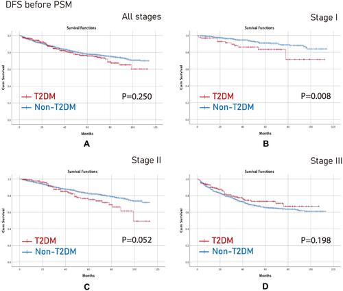 Figure 3 DFS before PSM. (A) All stages; (B) Stage I; (C) Stage II; (D) Stage III.