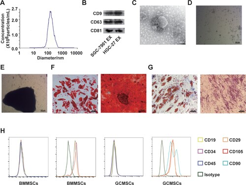 Figure 1. Identification of exosomes in gastric cancer (GC) cells and primary culture of cells. (A) Diameter ranges of GC-derived exosomes. (B) Protein expression of CD9, CD63, and CD81 in GC-derived exosomes was detected by western blot. (C) Transmission electron photomicrograph of GC-derived exosomes. (scale bar: 100 nm). (D) Primary culture of bone marrow mesenchymal stem cells (BMMSCs) (scale bar: 100 µm). (E) Primary culture of gastric cancer mesenchymal stem cells (GCMSCs) (scale bar: 100 µm) (F) Adipogenic and osteogenic differentiation of BMMSCs (scale bar: 100 µm). (G) Adipogenic and osteogenic differentiation of GCMSCs (scale bar: 100 µm). (H) Flow cytometry analysis of the surface markers on BMMSCs and GCMSCs (EX: exosome).