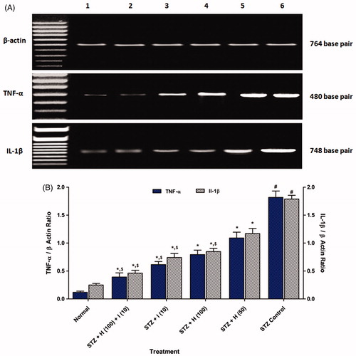 Figure 3. Effect of chronic treatment of hesperidin and insulin on (A) reverse transcriptase analysis of protein expression of TNF-α and IL-1β. (B) Quantitative representation of TNF-α and IL-1β protein expression. Data are expressed as mean ± SEM from six rats and analyzed by a one-way ANOVA followed by Tukey's multiple range test. *p < 0.05 as compared to the STZ diabetic control group, #p < 0.05 as compared to normal non-diabetic control animals, and $p < 0.05 as compared to one another group. STZ: diabetic (STZ) control rats; H (50): hesperidin (50 mg/kg, p.o.) treated rats; H (100): hesperidin (100 mg/kg, p.o.) treated rats; I (10): insulin (10 IU/kg, s.c.) treated rats; H (100) + I (10): hesperidin (100 mg/kg, p.o.), and insulin (10 IU/kg, s.c.) combination treated rats.