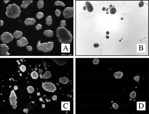 Figure 1.  DTZ-staining non-encapsulated (A) and encapsulated human islets (B) (light-microscope, 40x). Viability staining (Sytogreen, green for alive cells; Ethidium bromide, red for dead cells) non-encapsulated (C) and encapsulated islets (D).